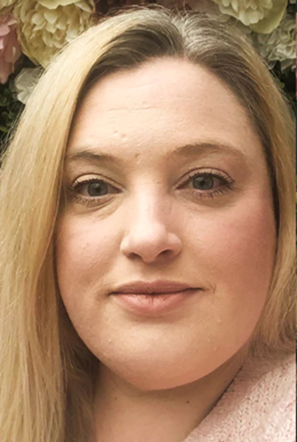 Image of Absoluter Bridgett before using Absolute Collagen's Collagen Supplement