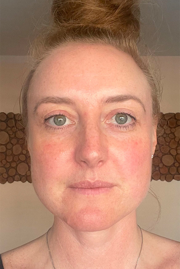 Image of Absoluter Claire after using Absolute Collagen's Collagen Supplement