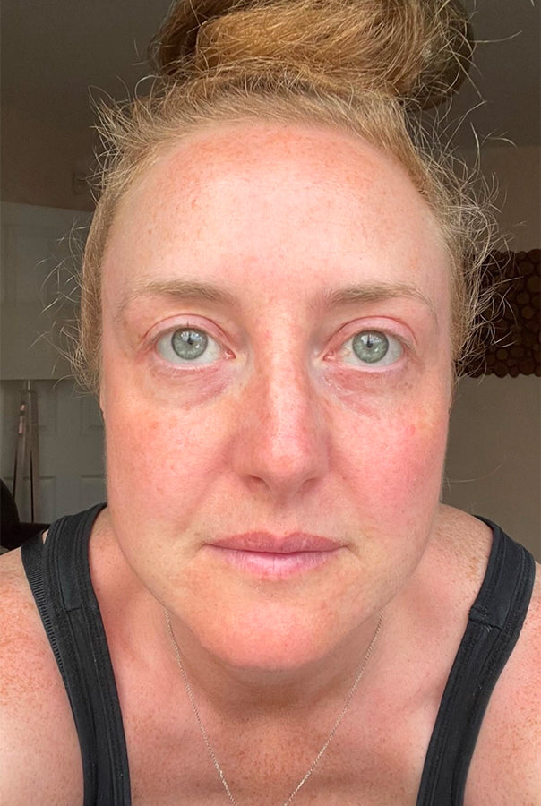 Image of Absoluter Claire before using Absolute Collagen's Collagen Supplement