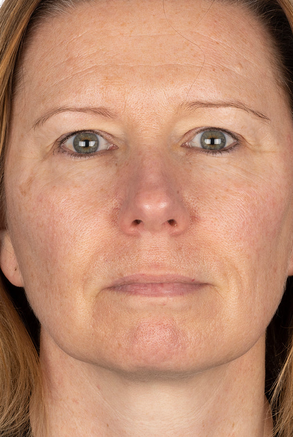Image of participant after using absolute collagen for 12 weeks